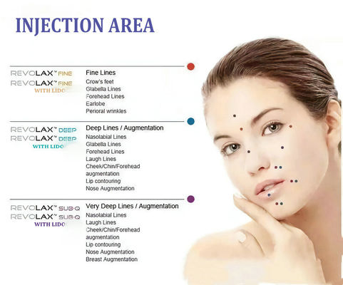 Iniezioni acide ialuroniche 1.1ml del labbro di Revolax