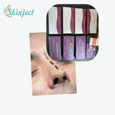 L'incrocio ha collegato il riempitore cutaneo acido ialuronico Juvederm ultra 3 ultra 4 Voluma