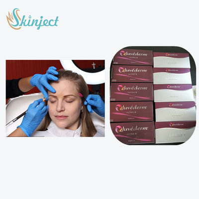 L'incrocio ha collegato il riempitore cutaneo acido ialuronico Juvederm ultra 3 1ml x 2