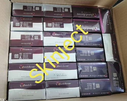 Riempitore cutaneo acido ialuronico di Juvederm Voluma per la grinza profonda