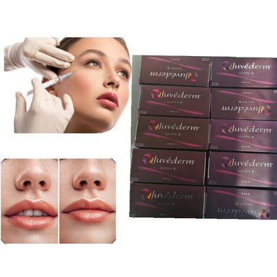 Riempitore cutaneo acido ialuronico Juvederm del riempitore del gel del labbro ultra 3 ultra 4