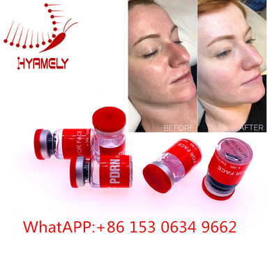 Iniezione mesa antinvecchiamento del siero con Hyaluron Pen Dermal Filler