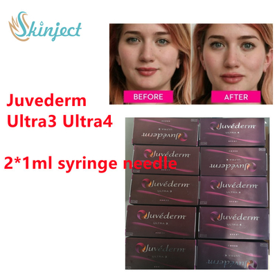 Riempitore cutaneo acido ialuronico del labbro di Juvederm del riempitore di Juvederm con lidocaina 2x1ml Ultra3 Ultra4