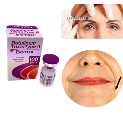 Allergan Botox 100IU Tossina Botulinica Tipo A Per Rimuovere Rughe Dal Volto E dagli Occhi
