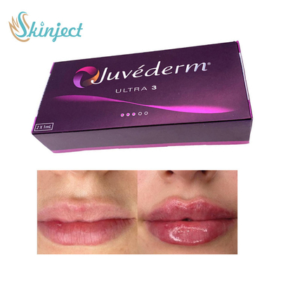 Riempitore acido ialuronico Juvederm Ultra3 del labbro 281ML cutaneo