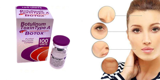 Tipo della tossina botulinica di Allergan una forma della polvere di