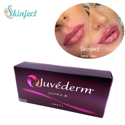 Riempitori facciali acidi ialuronici di Juvederm Ultra3 2x1ml cutanei