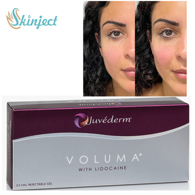Riempitori cutanei di Juvederm Voluma 2x1ml ha per lo zigomo Chin Contouring