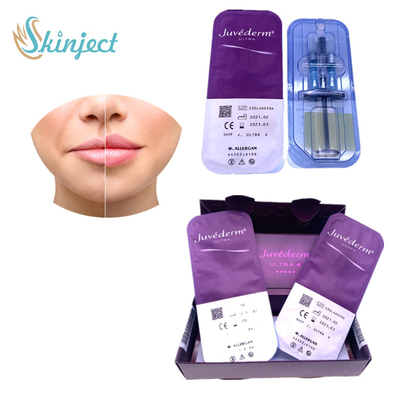 Acido ialuronico dei riempitori cutanei dell'ingrandimento del labbro di Juvederm Ultra4
