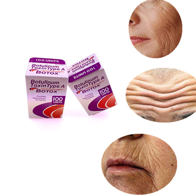 Coltivi le linee rimuovono Allergan una tossina botulinica da 100 IU per le linee della fronte