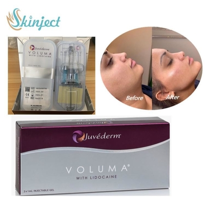 Acido ialuronico del riempitore cutaneo di Juvederm Voluma per la guancia facciale Chin Contour