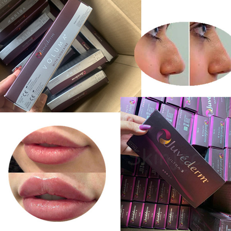 2 riempitore cutaneo acido ialuronico di ml Juvederm ultra 4 per il potenziamento sexy delle labbra