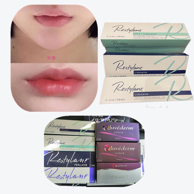 Prodotti anti-invecchiamento per riempimento cutaneo a base di acido ialuronico