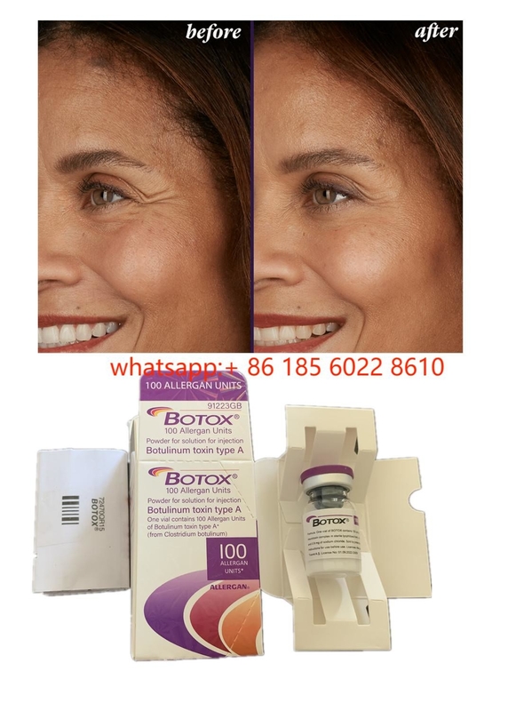 Prodotti di bellezza Allergan 100units Botulinum Toxin  Per rughe del viso Riempitore cutaneo