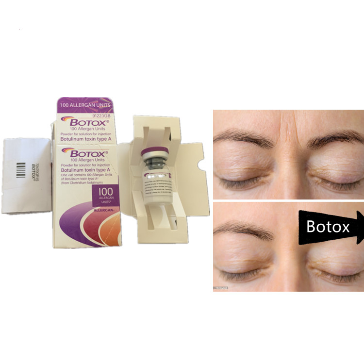 Allergan 100ui Botulinum Toxin Serum Prodotto anti-invecchiamento per disportare il viso