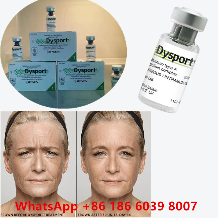 Tossina botulinica 100 unità BTX Iniezione Tipo A Uso cosmetico