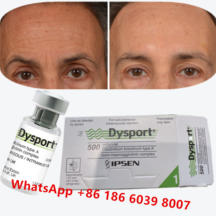 Dysport della tossina botulinica Clostridium botulinum tipo A per le zampe di corvo