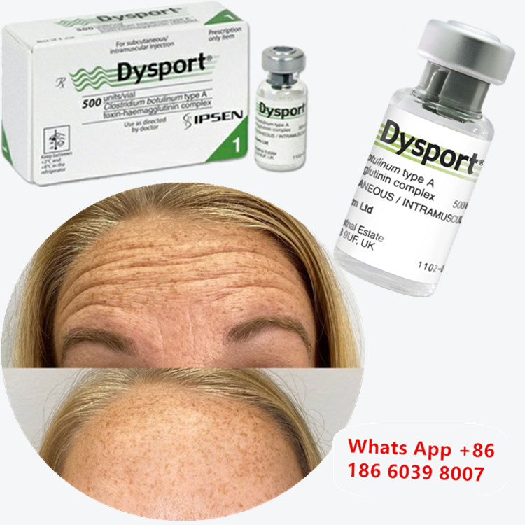 Tossina Botulinica Dysport Clostridium Botulinum Tipo A per Mentoniera a Fossetta
