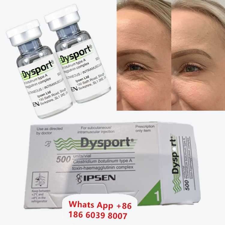 Dysport Botulinum Toxin Tipo A per le rughe del tronco lacrimale