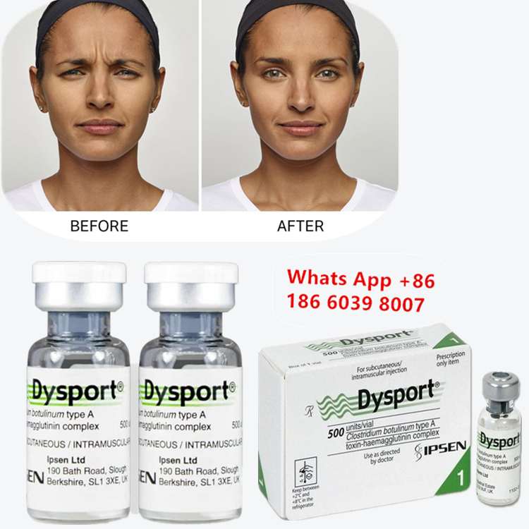 Dysport botulinum toxin tipo A per le linee fruncite e glabeliche