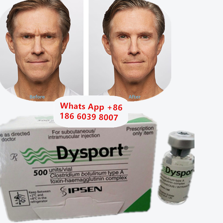 Dysport Botulinum Toxin Tipo A Polvere liofilizzata antirughe