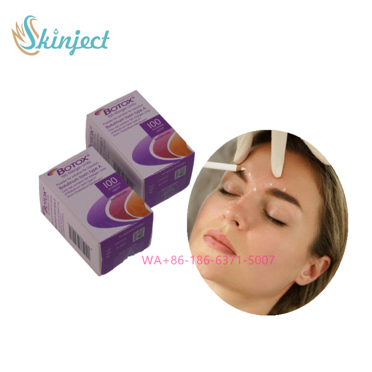 Allergan Botox 100UI iniettabile per la riduzione delle rughe, rughe della fronte, trattamento con tossina botulinica per la levigatezza