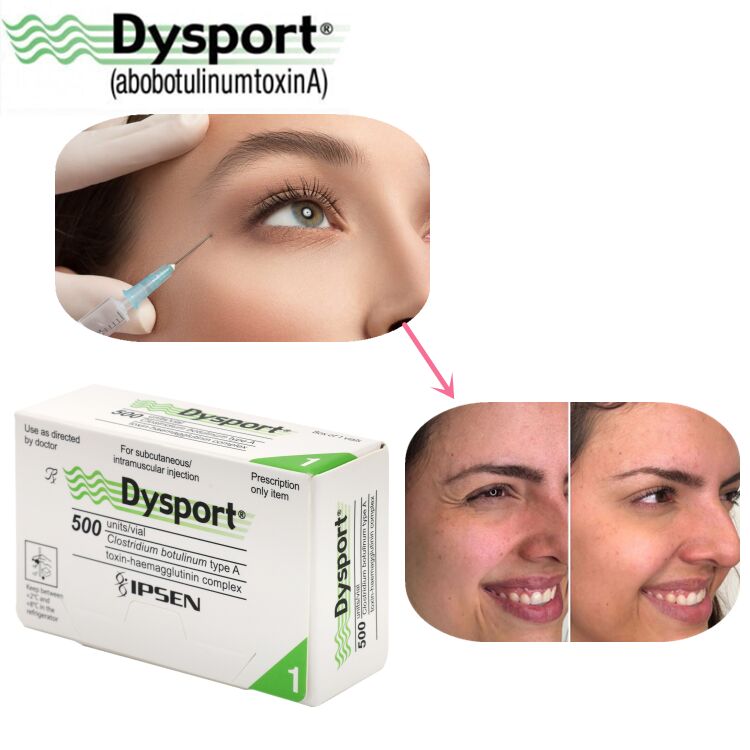 500u Dysport Scomparsa Rughe Viso Polvere Liofilizzata Lavorazione Personalizzata OEM Dysport