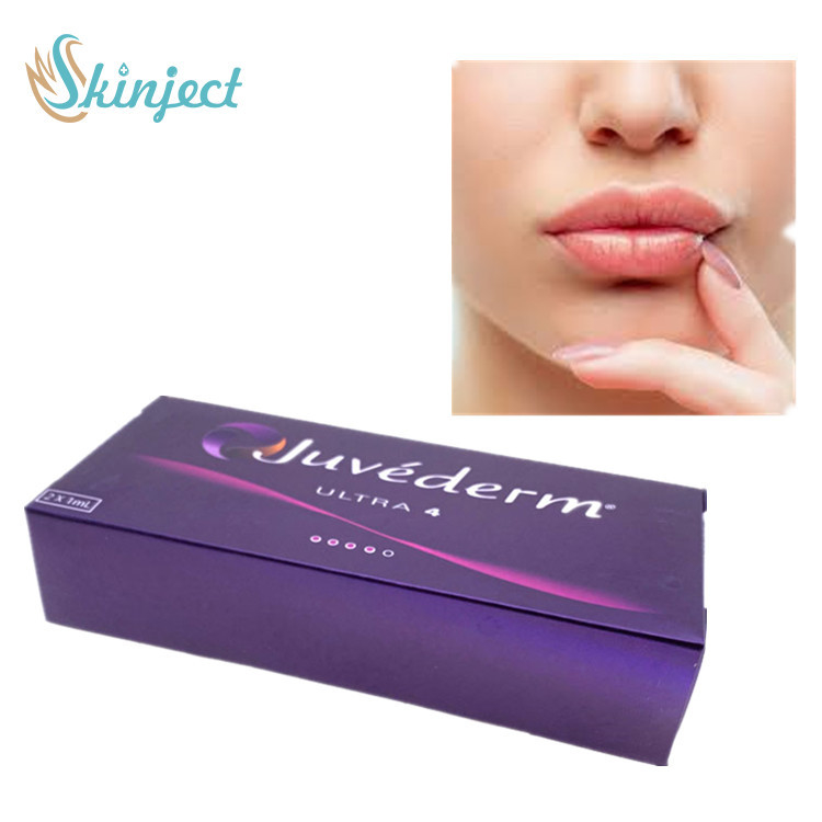 Il riempitore cutaneo ultra 4 di Juvederm per le labbra pela il riempitore cutaneo acido ialuronico del riempitore cutaneo