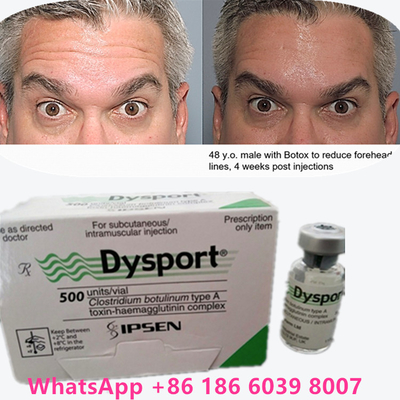 in polvere Dysport 100iu/1vials per la pelle invecchiata