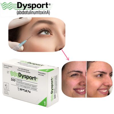 500u Dysport Scomparsa Rughe Viso Polvere Liofilizzata Lavorazione Personalizzata OEM Dysport